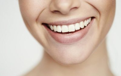Czy wybielanie zębów jest bezpieczne?